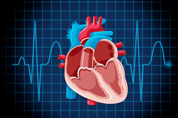 Structural Heart Interventions