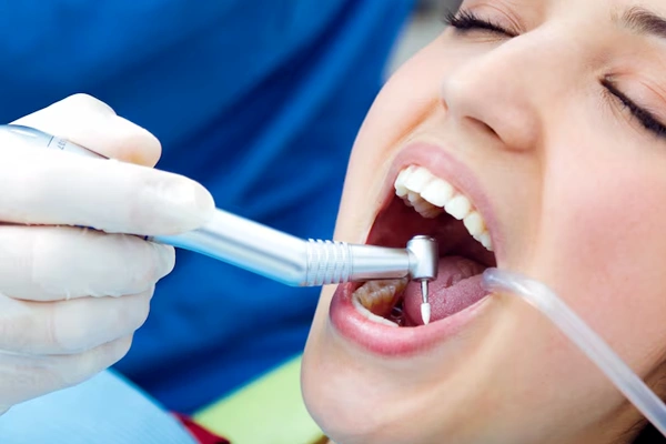 Scaling and Gum Treatment