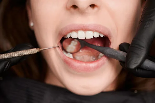 Gum Treatment